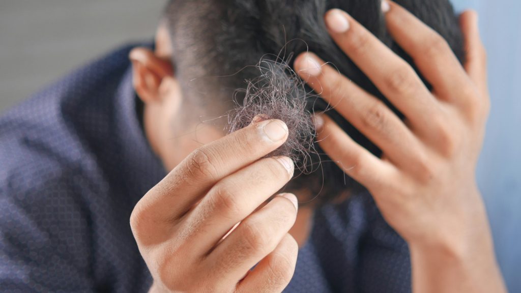 Pour choisir une greffe capillaire sur mesure ?